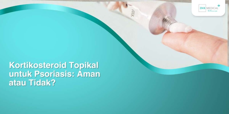 Kortikosteroid Topikal untuk Psoriasis: Aman atau Tidak?