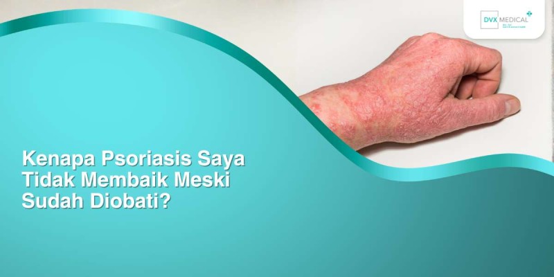 Kenapa Psoriasis Saya Tidak Membaik Meski Sudah Diobati?