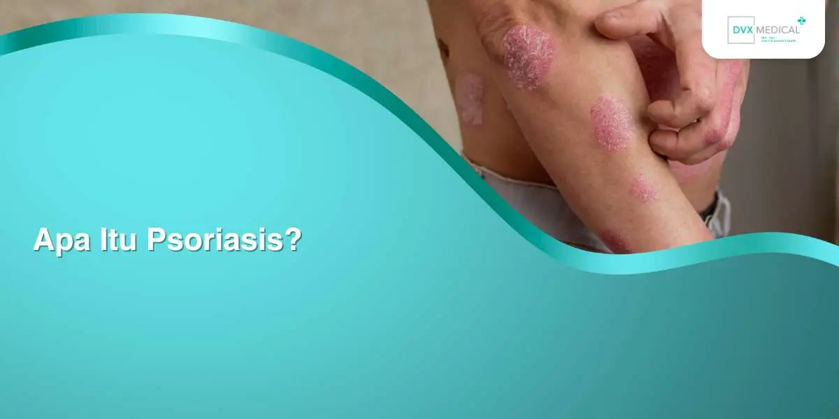 Apa Itu Psoriasis?
