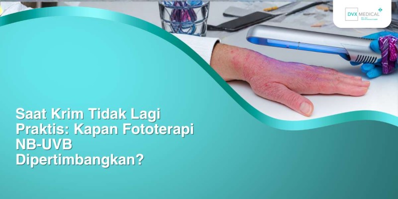 Saat Krim Tidak Lagi Praktis: Kapan Fototerapi NB-UVB Dipertimbangkan?