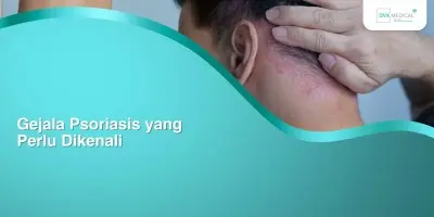 Gejala Psoriasis yang Perlu Dikenali