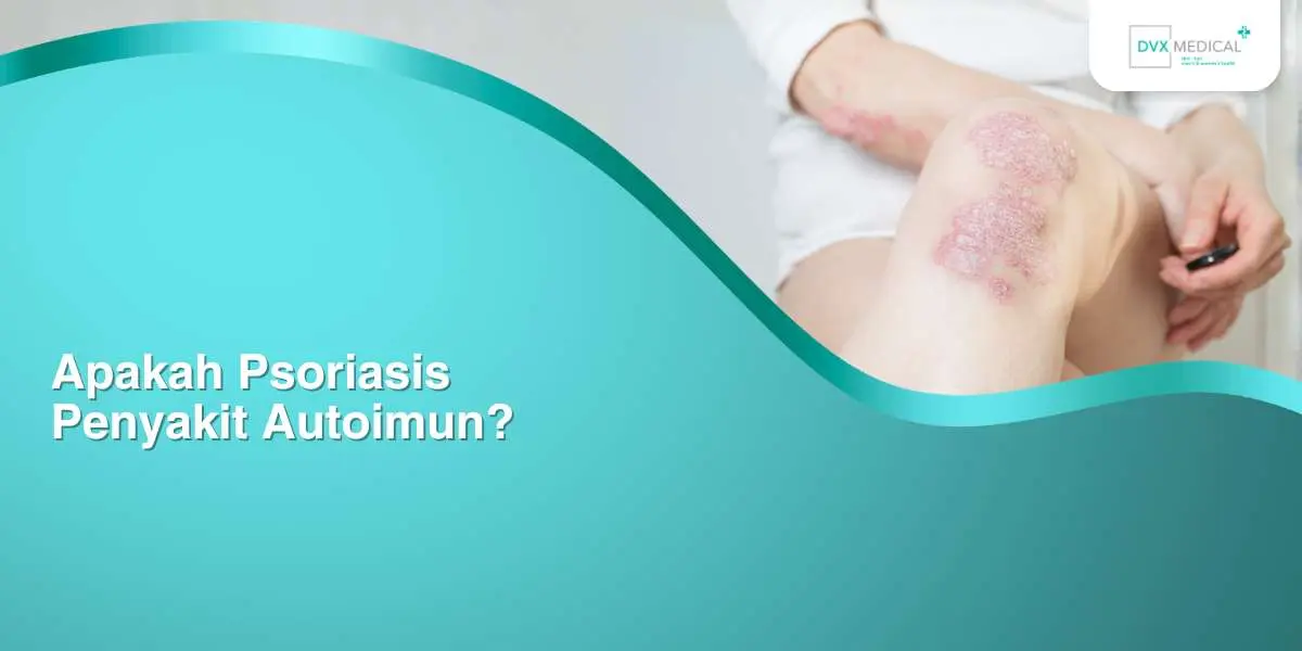 Apakah Psoriasis Penyakit Autoimun?