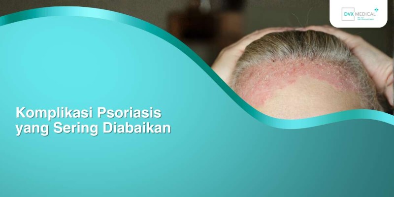 Komplikasi Psoriasis yang Sering Diabaikan