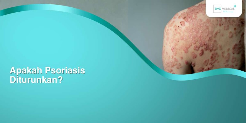 Apakah Psoriasis Diturunkan?