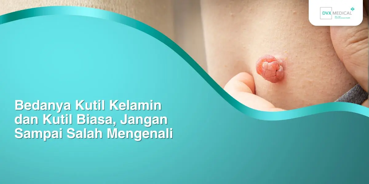 Bedanya Kutil Kelamin dan Kutil Biasa, Jangan Sampai Salah Mengenali