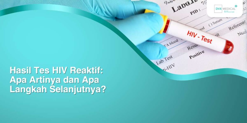 Hasil Tes HIV Reaktif: Apa Artinya dan Apa Langkah Selanjutnya?