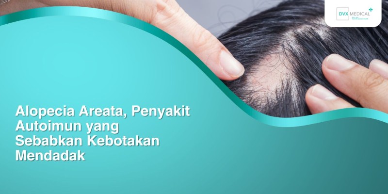 Alopecia Areata, Penyakit Autoimun yang Sebabkan Kebotakan Mendadak