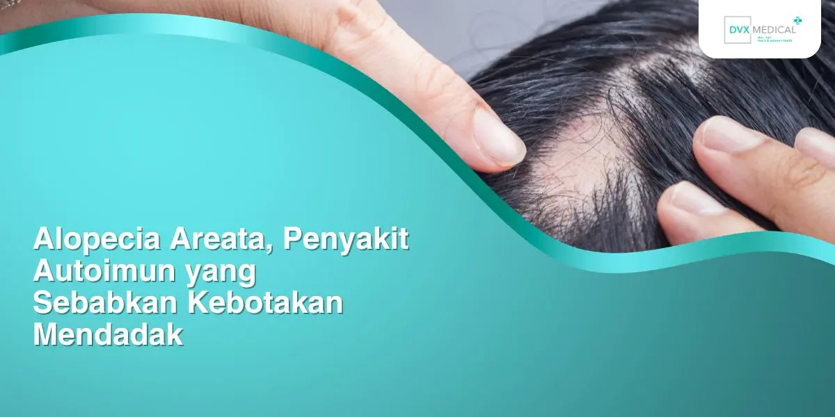 Alopecia Areata, Penyakit Autoimun yang Sebabkan Kebotakan Mendadak