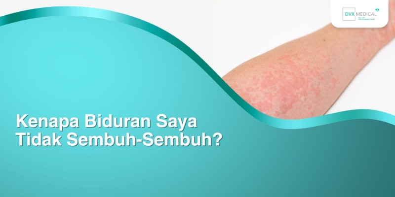 Kenapa Biduran Saya Tidak Sembuh-Sembuh?