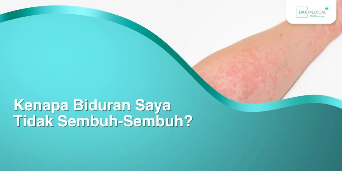 Kenapa Biduran Saya Tidak Sembuh-Sembuh?