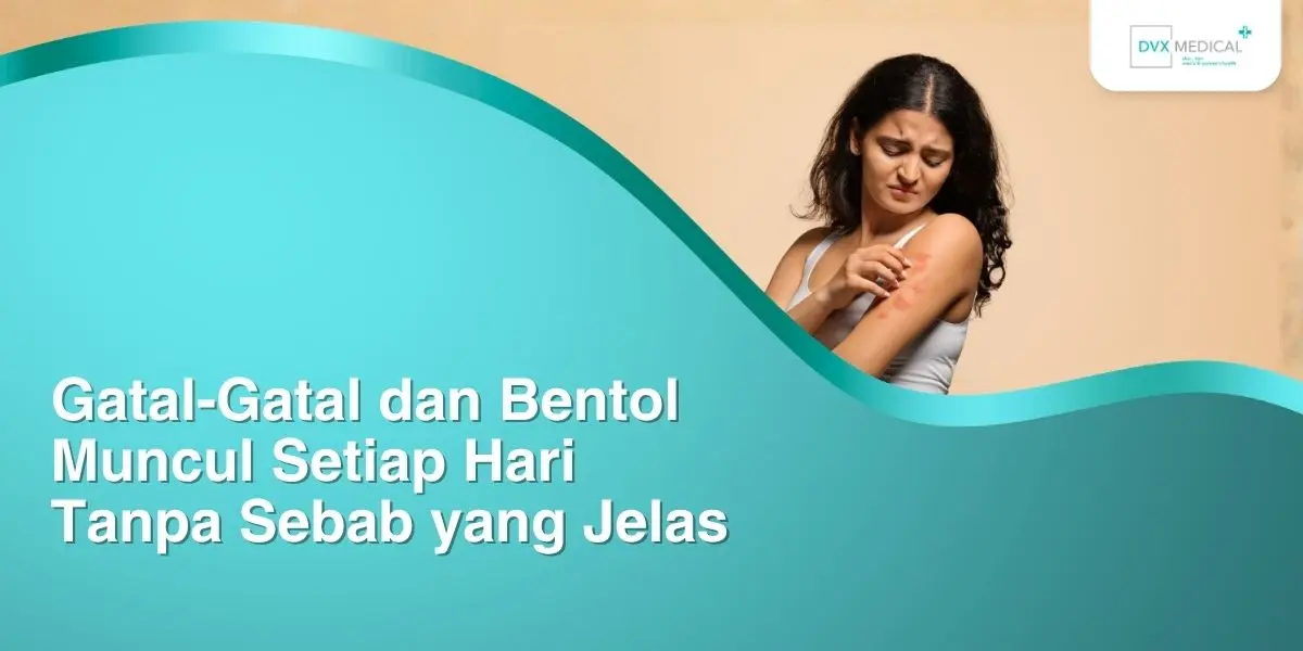 Gatal-Gatal dan Bentol Muncul Setiap Hari Tanpa Sebab yang Jelas Gatal-Gatal dan Bentol Muncul Setiap Hari Tanpa Sebab yang Jelas