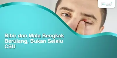 Bibir dan Mata Bengkak Berulang, Bukan Selalu CSU