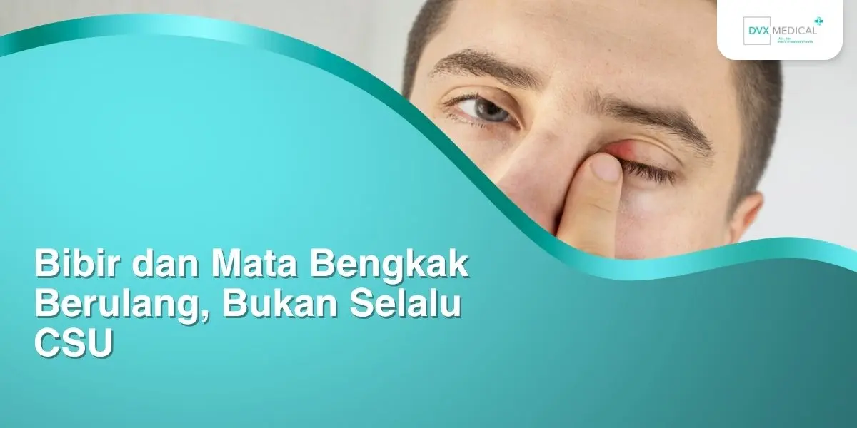 Bibir dan Mata Bengkak Berulang, Bukan Selalu CSU