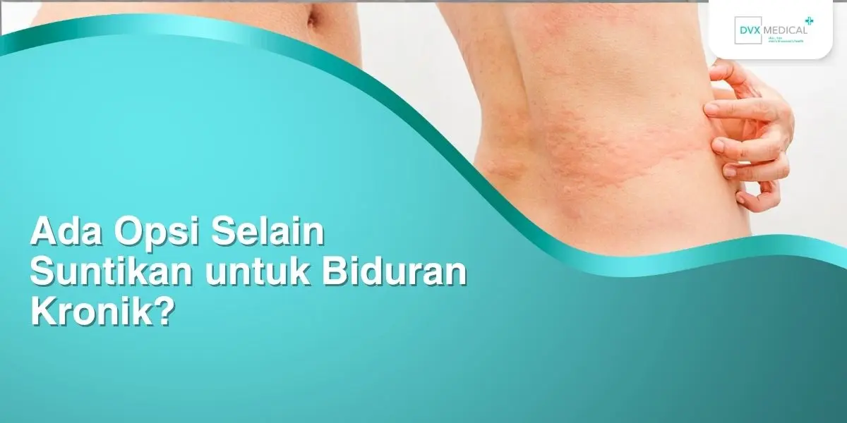 Ada Opsi Selain Suntikan untuk Biduran Kronik?
