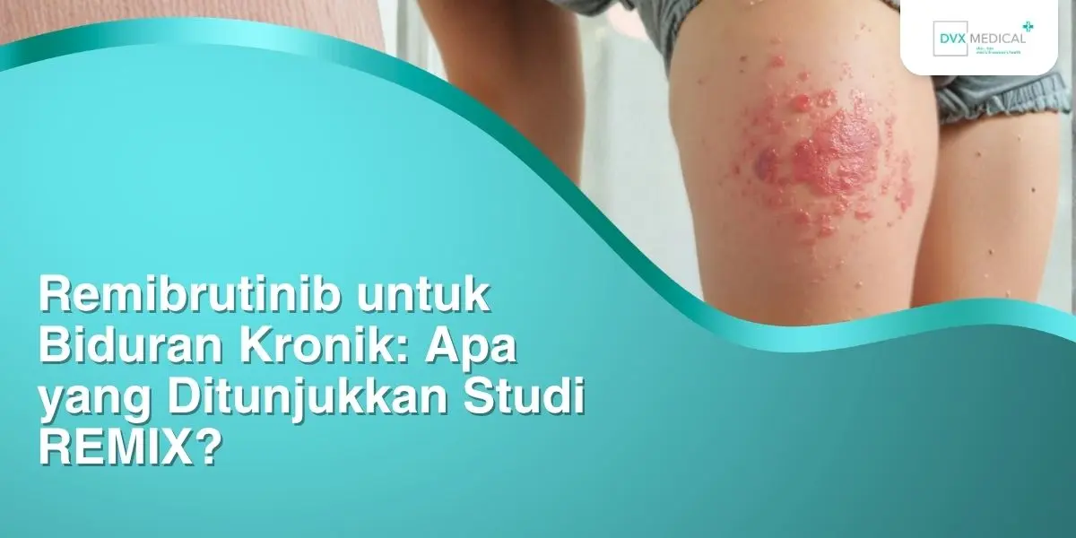 Remibrutinib untuk Biduran Kronik: Apa yang Ditunjukkan Studi REMIX?