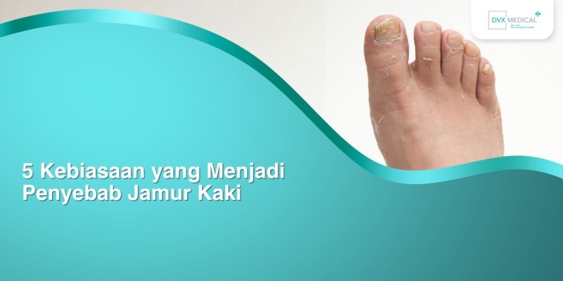 5 Kebiasaan yang Menjadi Penyebab Jamur Kaki