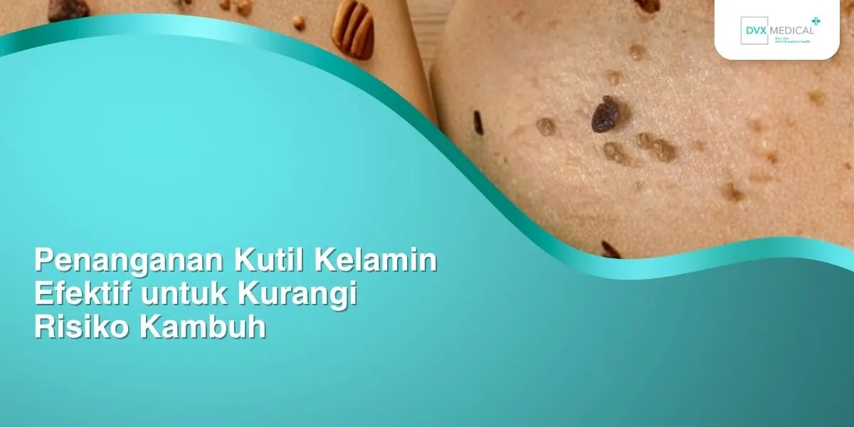 Penanganan Kutil Kelamin Efektif untuk Kurangi Risiko Kambuh