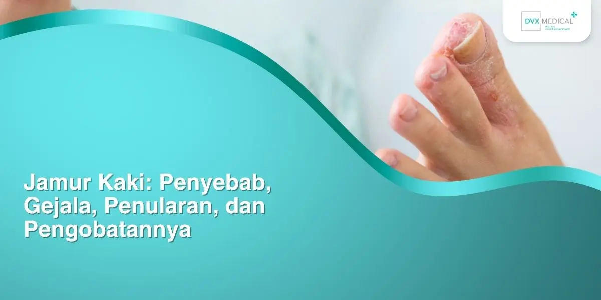 Jamur Kaki: Penyebab, Gejala, Penularan, dan Pengobatannya