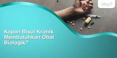 Kapan Bisul Kronik Membutuhkan Obat Biologik?