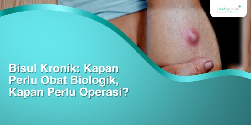 Bisul Kronik: Kapan Perlu Obat Biologik, Kapan Perlu Operasi?