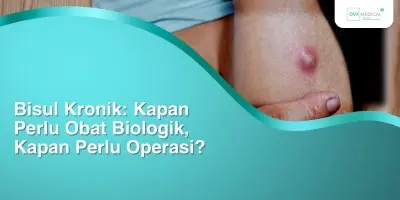 Bisul Kronik: Kapan Perlu Obat Biologik, Kapan Perlu Operasi?