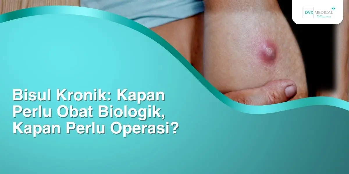 Bisul Kronik: Kapan Perlu Obat Biologik, Kapan Perlu Operasi?