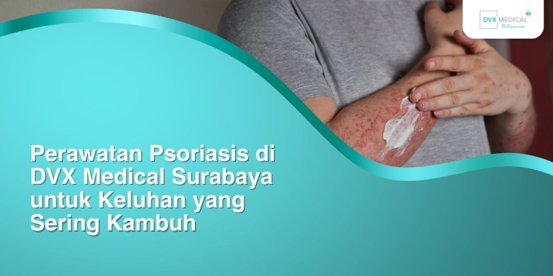 Perawatan Psoriasis di DVX Medical Surabaya untuk Keluhan yang Sering Kambuh