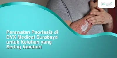 Perawatan Psoriasis di DVX Medical Surabaya untuk Keluhan yang Sering Kambuh