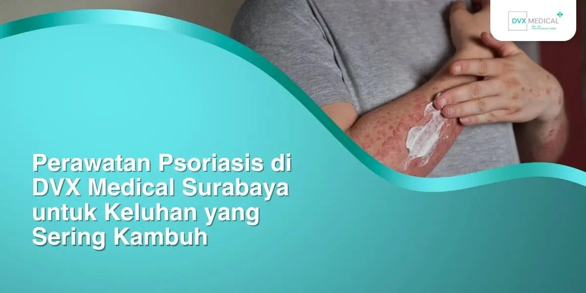 Perawatan Psoriasis di DVX Medical Surabaya untuk Keluhan yang Sering Kambuh