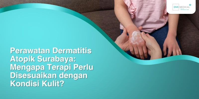 Perawatan Dermatitis Atopik Surabaya: Mengapa Terapi Perlu Disesuaikan dengan Kondisi Kulit?