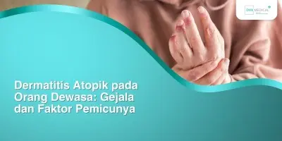 Dermatitis Atopik pada Orang Dewasa: Gejala dan Faktor Pemicunya