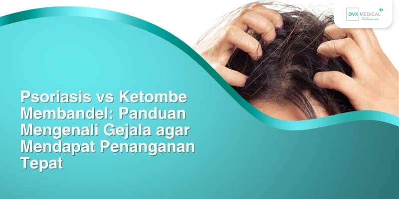 Psoriasis vs Ketombe Membandel: Panduan Mengenali Gejala agar Mendapat Penanganan Tepat