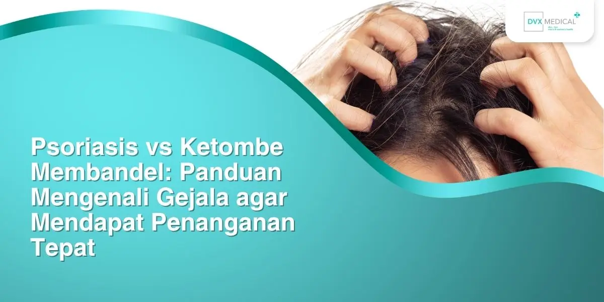 Psoriasis vs Ketombe Membandel: Panduan Mengenali Gejala agar Mendapat Penanganan Tepat