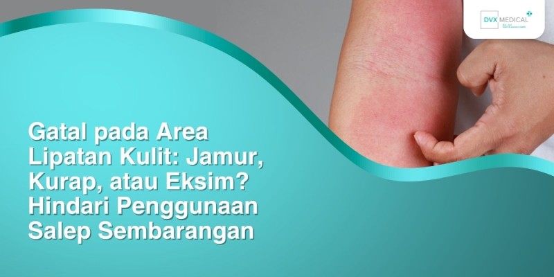 Gatal pada Area Lipatan Kulit: Jamur, Kurap, atau Eksim? Hindari Penggunaan Salep Sembarangan