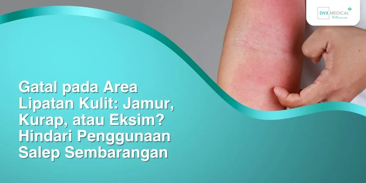 Gatal pada Area Lipatan Kulit: Jamur, Kurap, atau Eksim? Hindari Penggunaan Salep Sembarangan