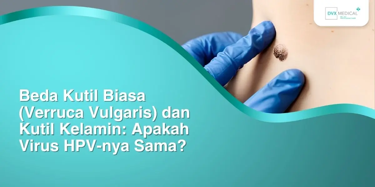 Beda Kutil Biasa (Verruca Vulgaris) dan Kutil Kelamin: Apakah Virus HPV-nya Sama?