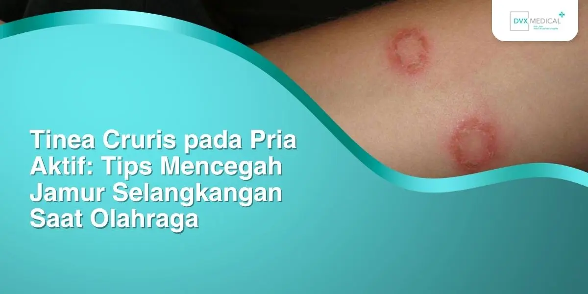 Tinea Cruris pada Pria Aktif: Tips Mencegah Jamur Selangkangan Saat Olahraga