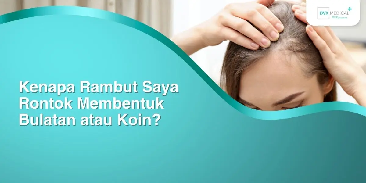 Kenapa Rambut Saya Rontok Membentuk Bulatan atau Koin?