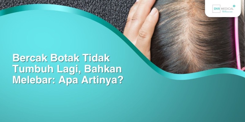 Bercak Botak Tidak Tumbuh Lagi, Bahkan Melebar: Apa Artinya?