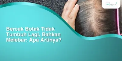 Bercak Botak Tidak Tumbuh Lagi, Bahkan Melebar: Apa Artinya?