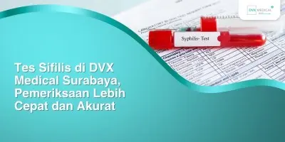 Tes Sifilis di DVX Medical Surabaya, Pemeriksaan Lebih Cepat dan Akurat