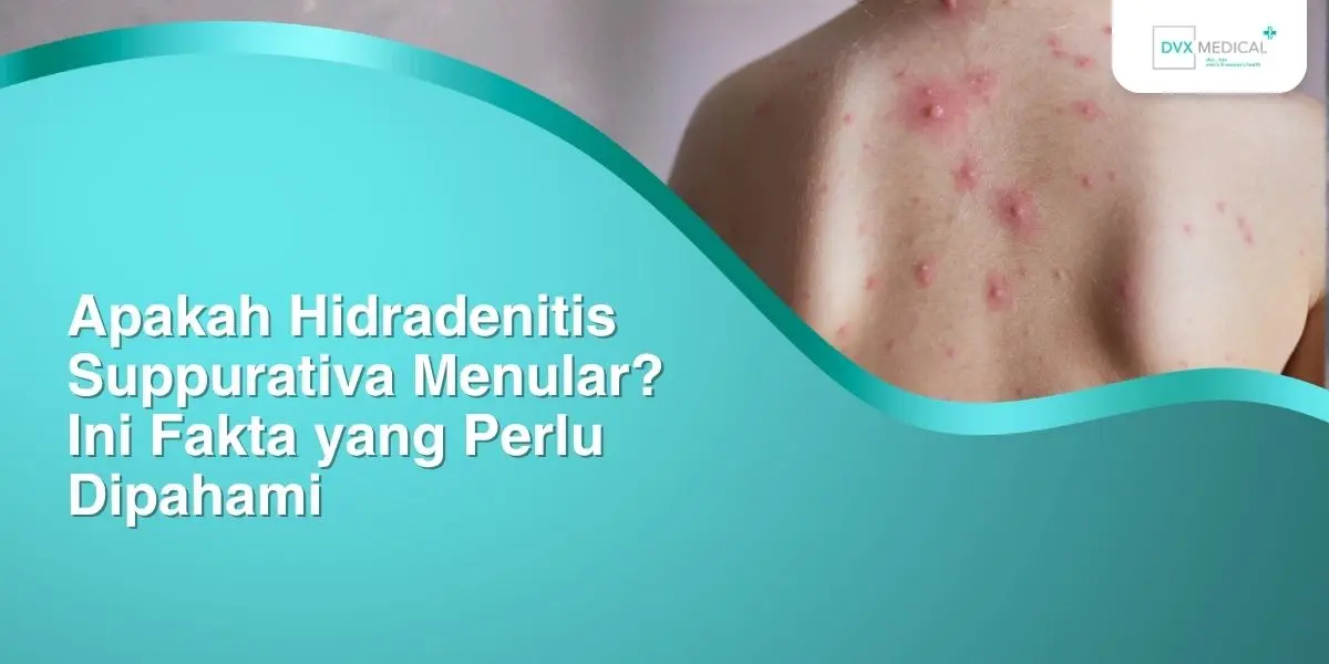 Apakah Hidradenitis Suppurativa Menular? Ini Fakta yang Perlu Dipahami