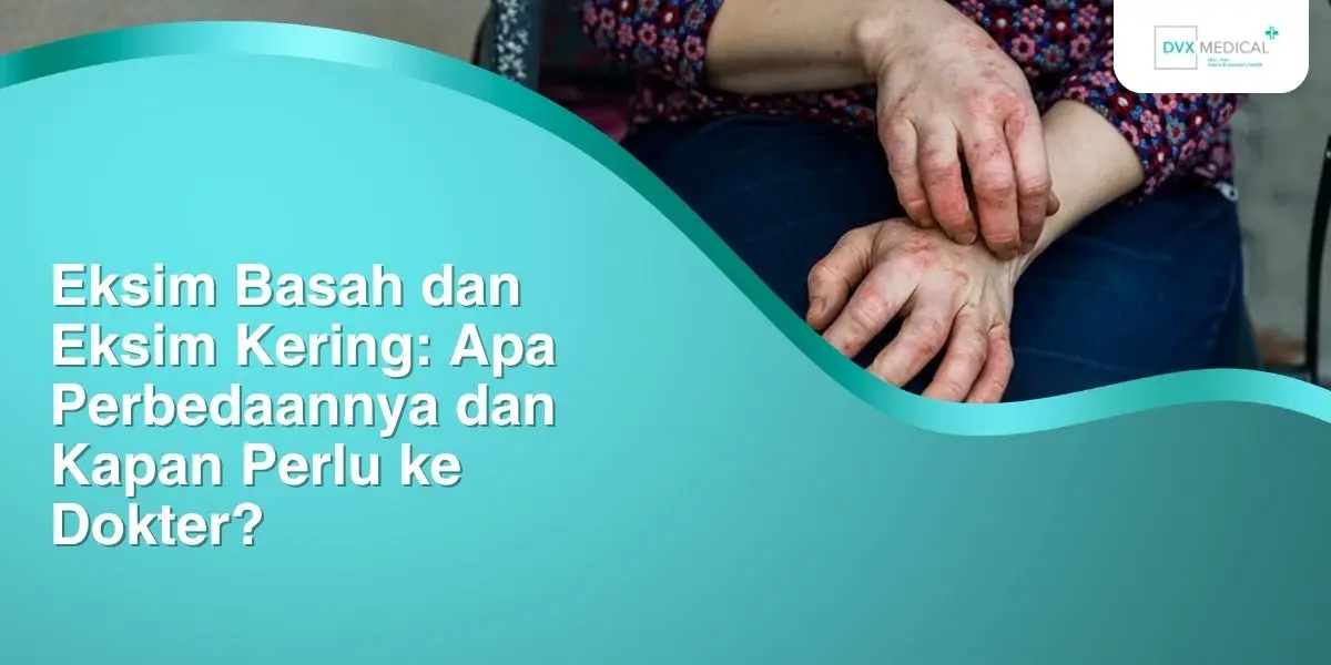 Eksim Basah dan Eksim Kering: Apa Perbedaannya dan Kapan Perlu ke Dokter?
