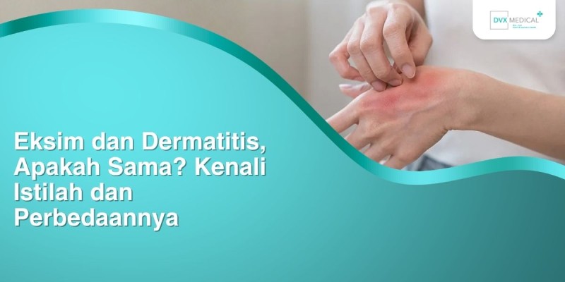 Eksim dan Dermatitis, Apakah Sama? Kenali Istilah dan Perbedaannya