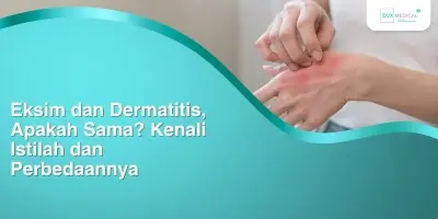 Eksim dan Dermatitis, Apakah Sama? Kenali Istilah dan Perbedaannya