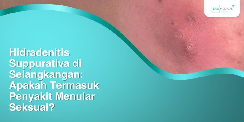 Hidradenitis Suppurativa di Selangkangan: Apakah Termasuk Penyakit Menular Seksual?