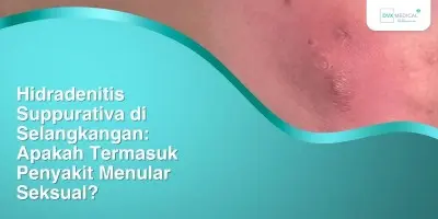 Hidradenitis Suppurativa di Selangkangan: Apakah Termasuk Penyakit Menular Seksual?