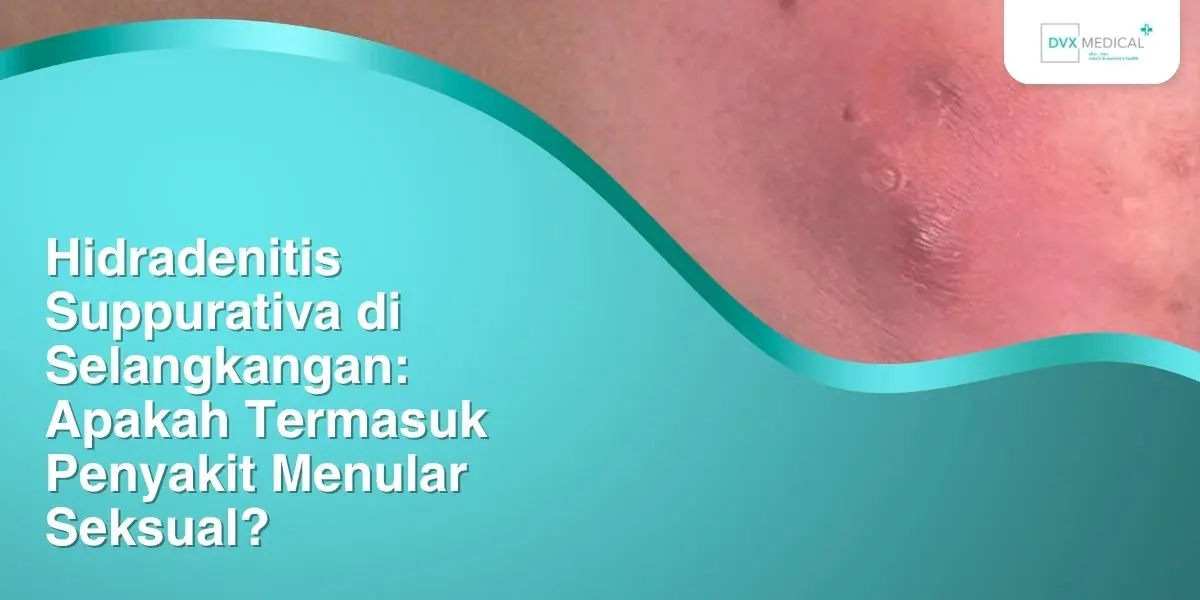 Hidradenitis Suppurativa di Selangkangan: Apakah Termasuk Penyakit Menular Seksual?