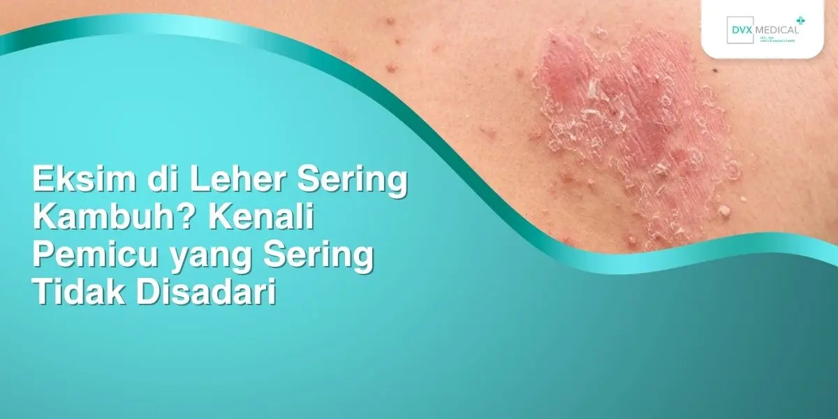 Eksim di Leher Sering Kambuh? Kenali Pemicu yang Sering Tidak Disadari