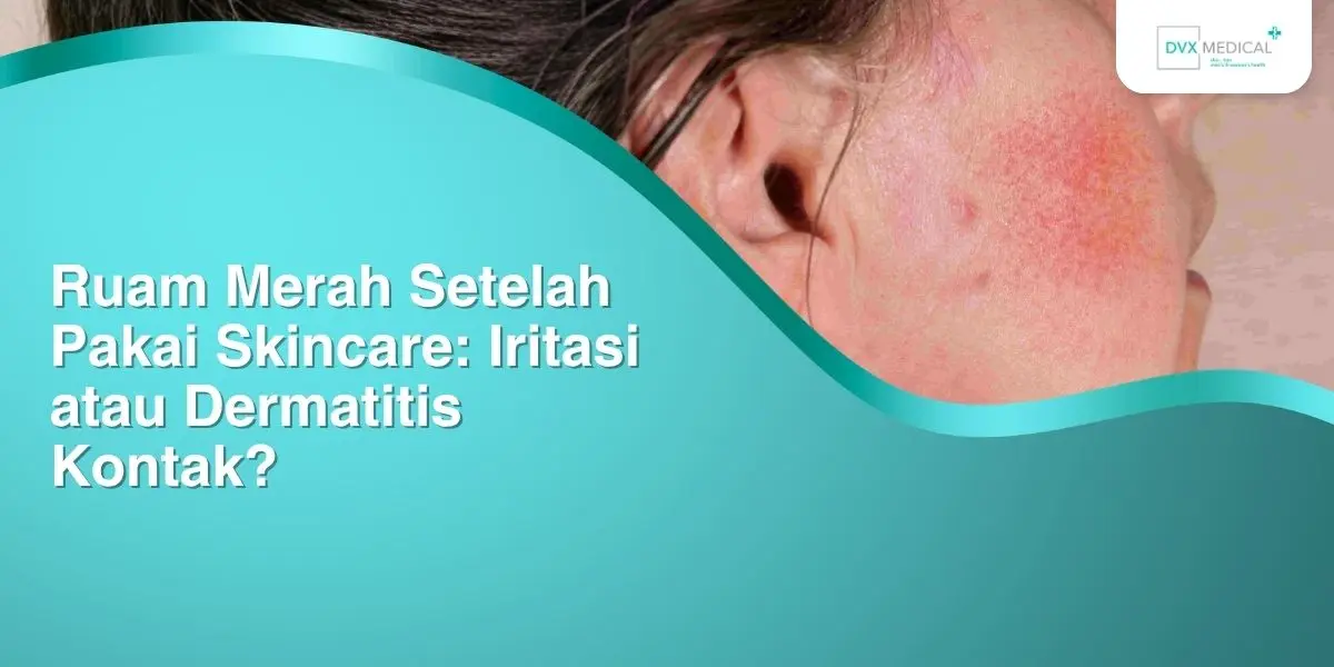 Ruam Merah Setelah Pakai Skincare: Iritasi atau Dermatitis Kontak?